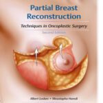 خرید و دانلود نسخه کامل کتاب Partial Breast Reconstruction: Techniques in Oncoplastic Surgery