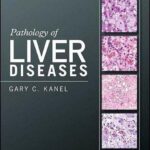 خرید و دانلود نسخه کامل کتاب Pathology of liver diseases