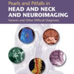 خرید و دانلود نسخه کامل کتاب Pearls and Pitfalls in head and neck and neuroimaging