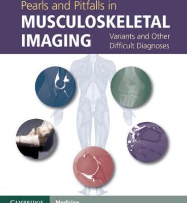 خرید و دانلود نسخه کامل کتاب Pearls and Pitfalls in Musculoskeletal Imaging: Variants and Other Difficult Diagnoses