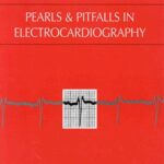 خرید و دانلود نسخه کامل کتاب Pearls & Pitfalls in Electrocardiography : Pithy, Practical Pointers 2nd Edition