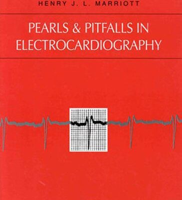 خرید و دانلود نسخه کامل کتاب Pearls & Pitfalls in Electrocardiography : Pithy, Practical Pointers 2nd Edition