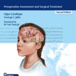 خرید و دانلود نسخه کامل کتاب Pediatric Epilepsy Surgery: Preoperative Assessment and Surgical Treatment