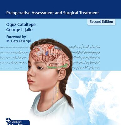 خرید و دانلود نسخه کامل کتاب Pediatric Epilepsy Surgery: Preoperative Assessment and Surgical Treatment