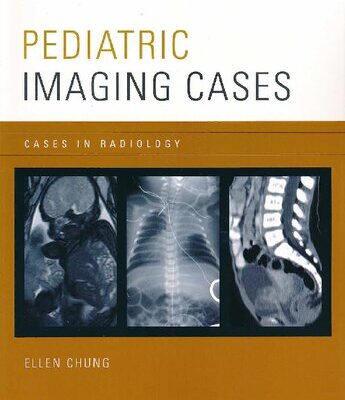 خرید و دانلود نسخه کامل کتاب Pediatric Imaging Cases (Cases in Radiology)