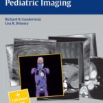 خرید و دانلود نسخه کامل کتاب Pediatric Imaging