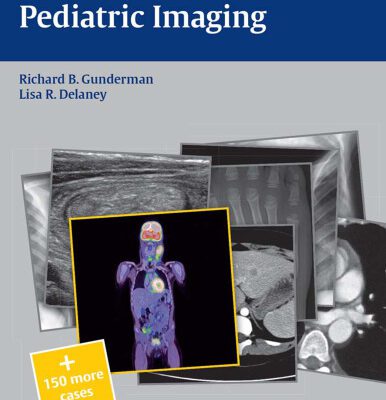 خرید و دانلود نسخه کامل کتاب Pediatric Imaging