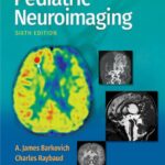 خرید و دانلود نسخه کامل کتاب Pediatric Neuroimaging