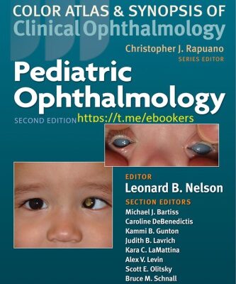خرید و دانلود نسخه کامل کتاب Pediatric Ophthalmology
