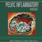 خرید و دانلود نسخه کامل کتاب Pelvic Inflammatory Disease (Deadly Diseases and Epidemics)