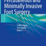 خرید و دانلود نسخه کامل کتاب Percutaneous and Minimally Invasive Foot Surgery