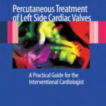 خرید و دانلود نسخه کامل کتاب Percutaneous Treatment of Left Side Cardiac Valves: A Practical Guide for the Interventional Cardiologist