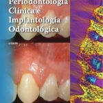 خرید و دانلود نسخه کامل کتاب Periodontología Clínica e Implantología Odontológica TOMO 1 y 2 by KADUR