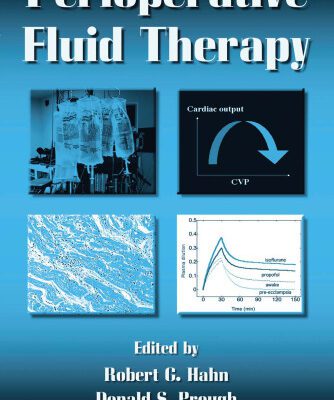 خرید و دانلود نسخه کامل کتاب Perioperative Fluid Therapy