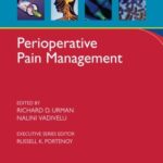 خرید و دانلود نسخه کامل کتاب Perioperative Pain Management