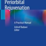 خرید و دانلود نسخه کامل کتاب Periorbital Rejuvenation: A Practical Manual
