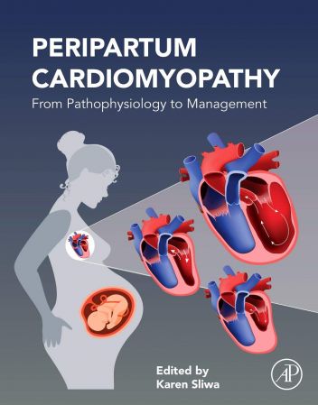 خرید و دانلود نسخه کامل کتاب Peripartum Cardiomyopathy: From Pathophysiology to Management_68baa4b24ec1f.jpeg خرید و دانلود نسخه کامل کتاب Peripartum Cardiomyopathy: From Pathophysiology to Management