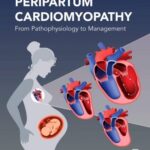 خرید و دانلود نسخه کامل کتاب Peripartum Cardiomyopathy: From Pathophysiology to Management
