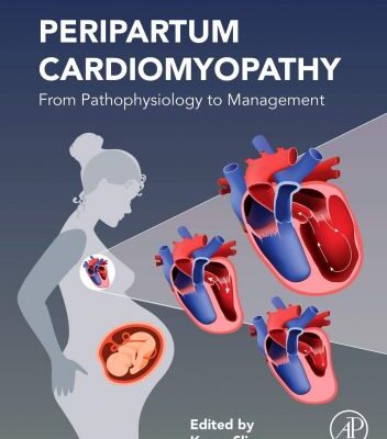 خرید و دانلود نسخه کامل کتاب Peripartum Cardiomyopathy: From Pathophysiology to Management