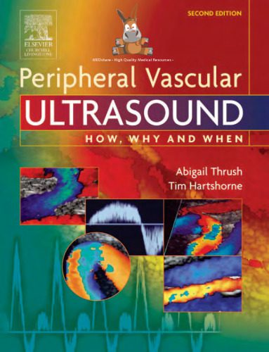 خرید و دانلود نسخه کامل کتاب Peripheral vascular ultrasound: how, why, and when_68bab3cc85ad0.jpeg خرید و دانلود نسخه کامل کتاب Peripheral vascular ultrasound: how, why, and when
