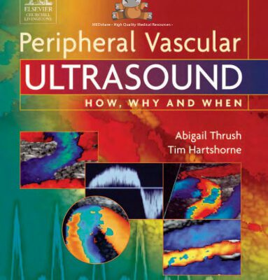 خرید و دانلود نسخه کامل کتاب Peripheral vascular ultrasound: how, why, and when