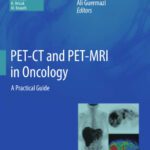 خرید و دانلود نسخه کامل کتاب PET-CT and PET-MRI in Oncology: A Practical Guide