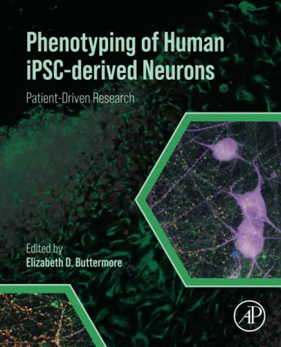 خرید و دانلود نسخه کامل کتاب Phenotyping of Human iPSC-derived Neurons: Patient-Driven Research_68bb1d9110708.jpeg خرید و دانلود نسخه کامل کتاب Phenotyping of Human iPSC-derived Neurons: Patient-Driven Research