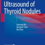 خرید و دانلود نسخه کامل کتاب Pitfalls in Ultrasound of Thyroid Nodules