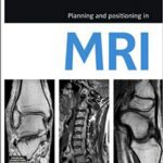 خرید و دانلود نسخه کامل کتاب Planning and Positioning in MRI