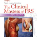 خرید و دانلود نسخه کامل کتاب Plastic Surgery Complete: The Clinical Masters of PRS: Breast Reduction