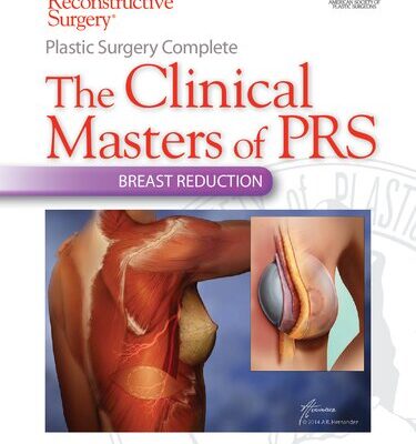 خرید و دانلود نسخه کامل کتاب Plastic Surgery Complete: The Clinical Masters of PRS: Breast Reduction