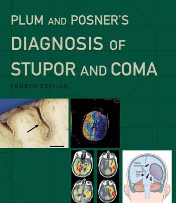 خرید و دانلود نسخه کامل کتاب Plum and Posner’s Diagnosis of Stupor and Coma (Contemporary Neurology71)