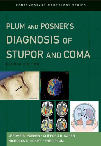 خرید و دانلود نسخه کامل کتاب Plum and Posner’s Diagnosis of Stupor and Coma (Contemporary Neurology71)_68bb2a01ba3ba.jpeg خرید و دانلود نسخه کامل کتاب Plum and Posner’s Diagnosis of Stupor and Coma (Contemporary Neurology71)