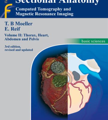 خرید و دانلود نسخه کامل کتاب Pocket Atlas of Sectional Anatomy, Computed Tomography and Magnetic Resonance Imaging: Thorax, Heart, Abdomen, and Pelvis
