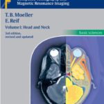 خرید و دانلود نسخه کامل کتاب Pocket Atlas Of Sectional Anatomy. Ct And Mri Head And Neck