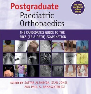 خرید و دانلود نسخه کامل کتاب Postgraduate Paediatric Orthopaedics: The Candidate’s Guide to the FRCS (Tr&Orth) Examination
