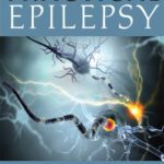 خرید و دانلود نسخه کامل کتاب Practical Epilepsy