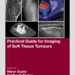 خرید و دانلود نسخه کامل کتاب Practical Guide for Imaging of Soft Tissue Tumours