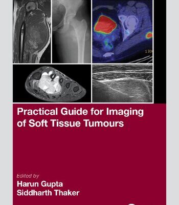 خرید و دانلود نسخه کامل کتاب Practical Guide for Imaging of Soft Tissue Tumours