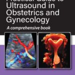 خرید و دانلود نسخه کامل کتاب Practical Guide to Ultrasound in Obstetrics and Gynecology: A Comprehensive Book