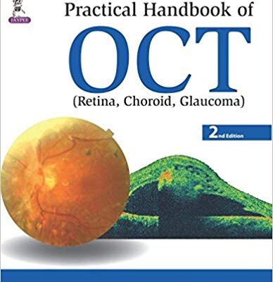 خرید و دانلود نسخه کامل کتاب Practical Handbook of Oct Retina, Choroid, Glaucoma 2nd Edition