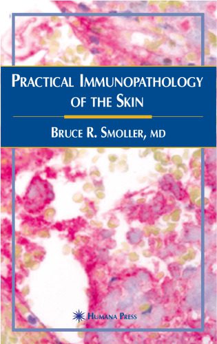 خرید و دانلود نسخه کامل کتاب Practical Immunopathology of the Skin (Current Clinical Pathology)_68ba24976d0d6.jpeg خرید و دانلود نسخه کامل کتاب Practical Immunopathology of the Skin (Current Clinical Pathology)