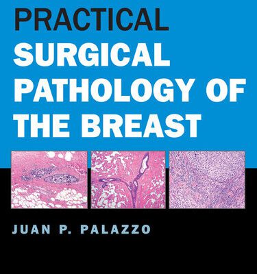 خرید و دانلود نسخه کامل کتاب Practical Surgical Pathology of the Breast