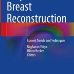 خرید و دانلود نسخه کامل کتاب Prepectoral Breast Reconstruction: Current Trends and Techniques