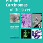 خرید و دانلود نسخه کامل کتاب Primary Carcinomas of the Liver (Contemporary Issues in Cancer Imaging)