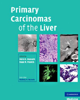خرید و دانلود نسخه کامل کتاب Primary Carcinomas of the Liver (Contemporary Issues in Cancer Imaging)