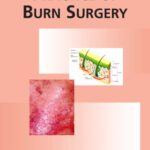خرید و دانلود نسخه کامل کتاب Principles and Practice of Burn Surgery