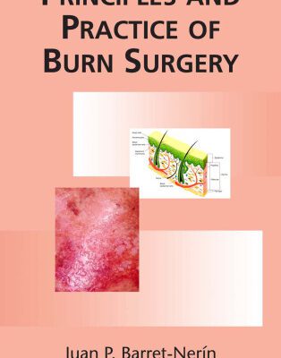 خرید و دانلود نسخه کامل کتاب Principles and Practice of Burn Surgery