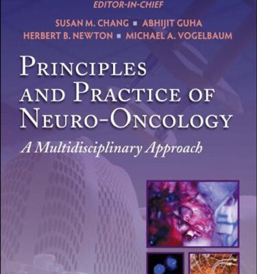 خرید و دانلود نسخه کامل کتاب Principles and practice of neuro-oncology : a multidisciplinary approach