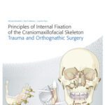 خرید و دانلود نسخه کامل کتاب Principles of Internal Fixation of the Craniomaxillofacial Skeleton: Trauma and Othognathic Surgery